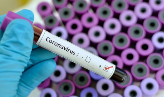 تازه‌ترین گزارش دربارۀ شیوع ویروس کرونا در سراسر جهان