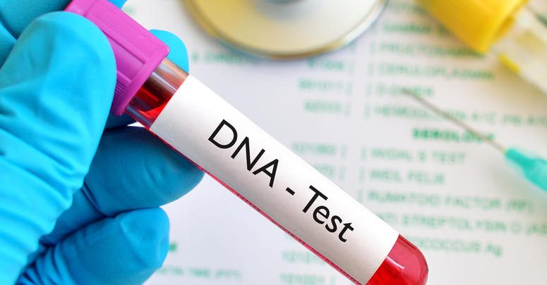 هزینۀ آزمایشات ژنتیک برای مددجویان بهزیستی رایگان است