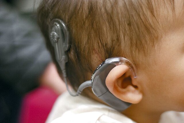 شناسایی ۱۹۰۰ نوزاد دارای اختلال شنوایی طی هشت ماه امسال