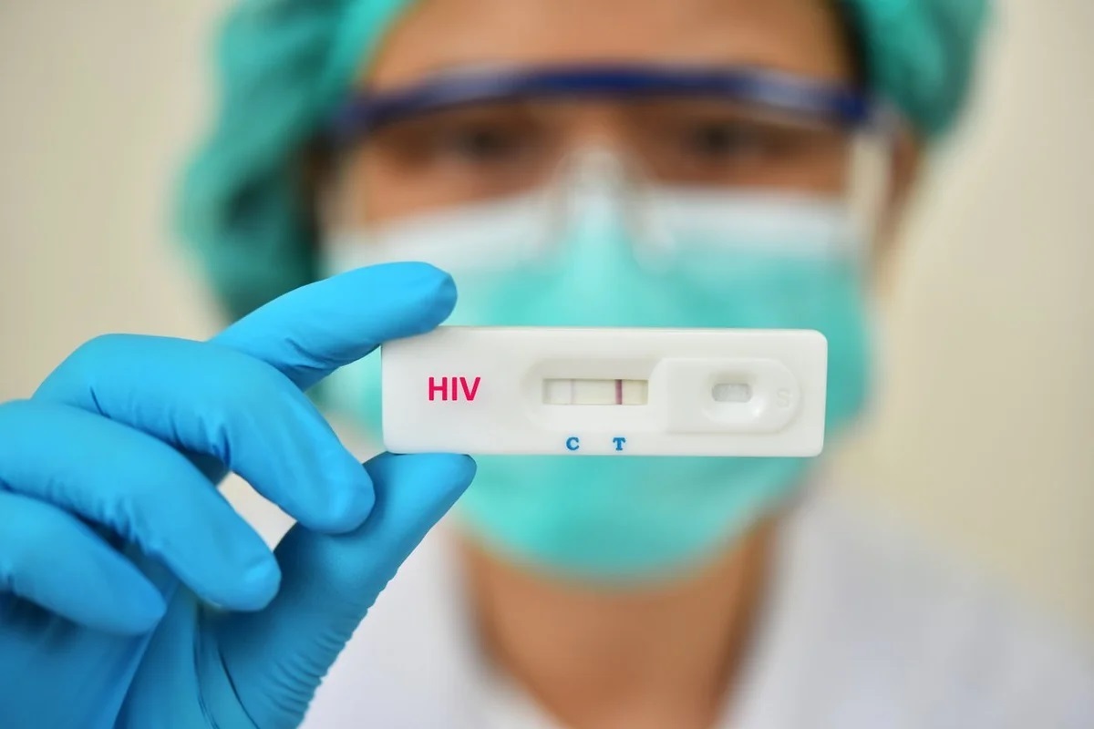 نیمی از افراد مبتلا به HIV از بیماری خود اطلاع ندارند