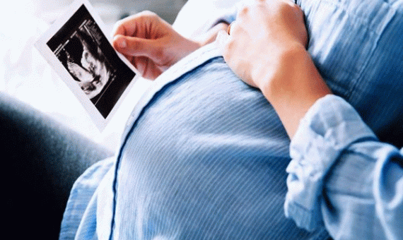 زنان باردار چاق بیشتر در معرض ابتلا به کرونا هستند