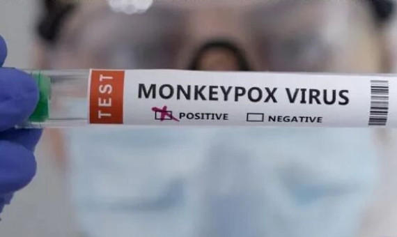 بیمار مبتلا به آبله‌ میمونی در ایران بهبود یافت