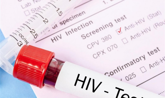 ۵۵ هزار مبتلا به اچ‌آی‌وی در کشور داریم