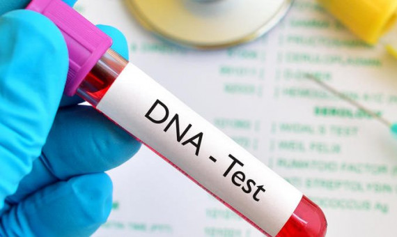 هزینۀ آزمایشات ژنتیک برای مددجویان بهزیستی رایگان است