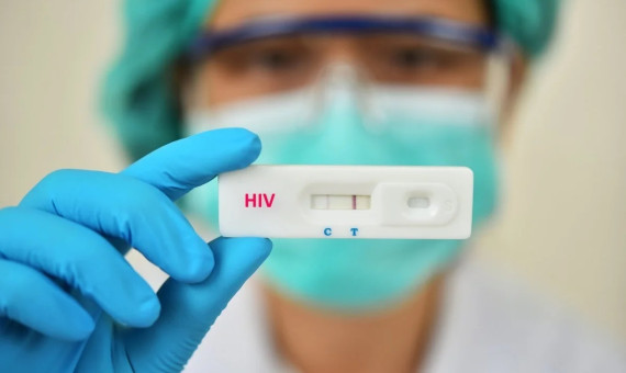 نیمی از افراد مبتلا به HIV از بیماری خود اطلاع ندارند